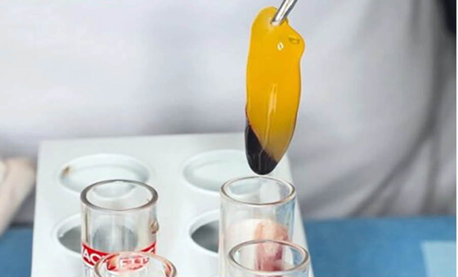 Công nghệ nhổ răng ghép PRF nhanh lành thương