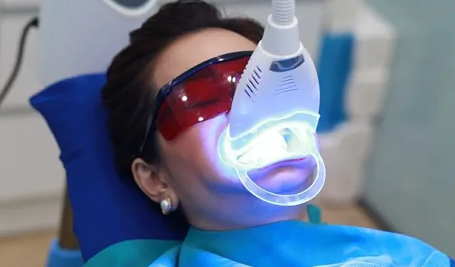 Tẩy Trắng Răng